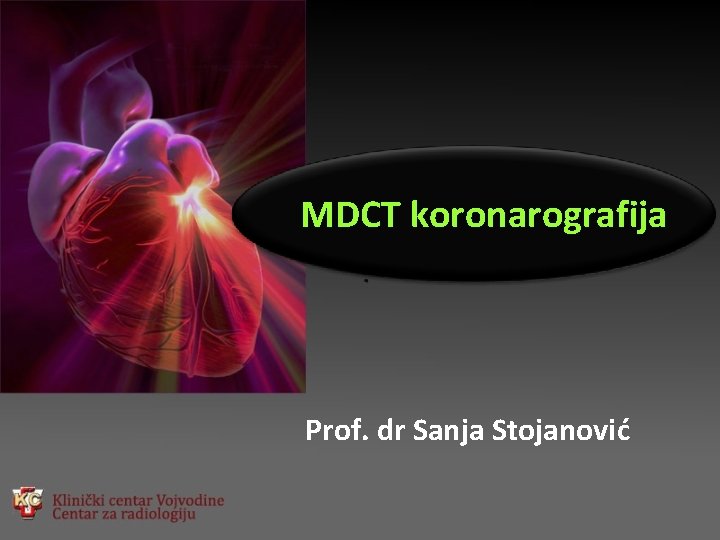 MDCT koronarografija Prof. dr Sanja Stojanović MDCT koronarografija Prof. dr Sanja Stojanović