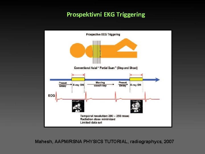 Prospektivni EKG Triggering Mahesh, AAPM/RSNA PHYSICS TUTORIAL, radiographycs, 2007 Prospektivni EKG Triggering Mahesh, AAPM/RSNA PHYSICS TUTORIAL, radiographycs, 2007