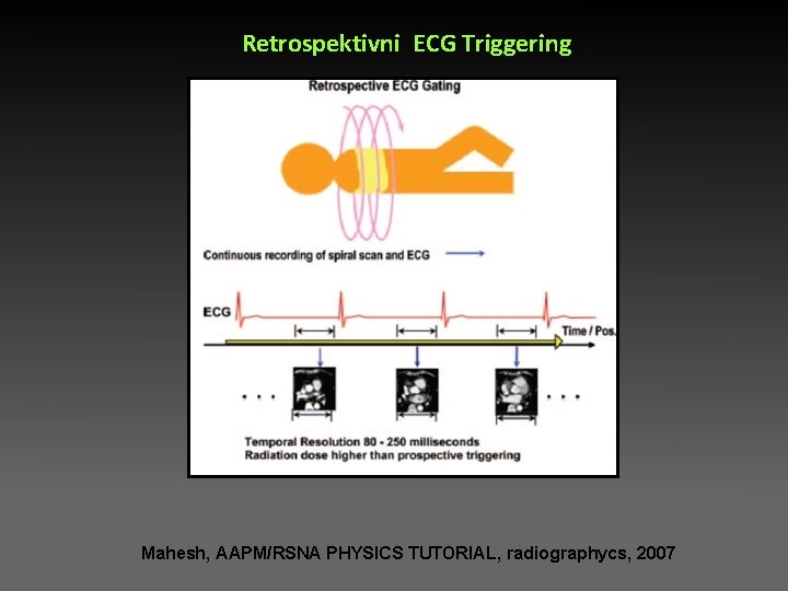 Retrospektivni ECG Triggering Mahesh, AAPM/RSNA PHYSICS TUTORIAL, radiographycs, 2007 Retrospektivni ECG Triggering Mahesh, AAPM/RSNA PHYSICS TUTORIAL, radiographycs, 2007