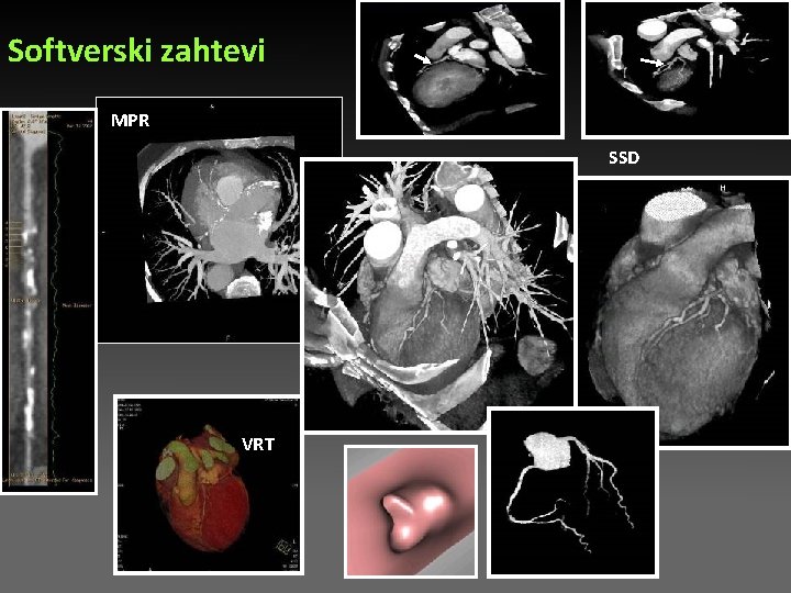 Softverski zahtevi MPR SSD VRT Softverski zahtevi MPR SSD VRT