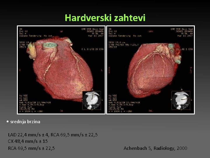 Hardverski zahtevi • srednja brzina LAD 22, 4 mm/s ± 4, RCA 69, 5 Hardverski zahtevi • srednja brzina LAD 22, 4 mm/s ± 4, RCA 69, 5