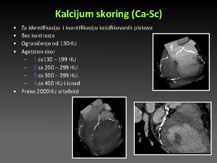 Kalcijum skoring (Ca-Sc) • • Za identifikaciju i kvantifikaciju kalcifikovanih plakova Bez kontrasta Ograničenje Kalcijum skoring (Ca-Sc) • • Za identifikaciju i kvantifikaciju kalcifikovanih plakova Bez kontrasta Ograničenje