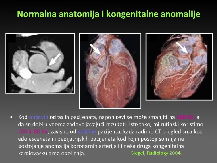 Normalna anatomija i kongenitalne anomalije • Kod mršavih odraslih pacijenata, napon cevi se može Normalna anatomija i kongenitalne anomalije • Kod mršavih odraslih pacijenata, napon cevi se može