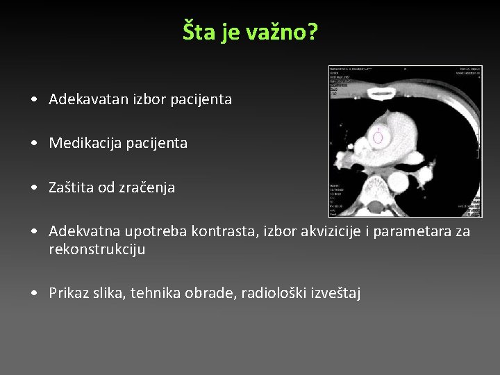Šta je važno? • Adekavatan izbor pacijenta • Medikacija pacijenta • Zaštita od zračenja Šta je važno? • Adekavatan izbor pacijenta • Medikacija pacijenta • Zaštita od zračenja