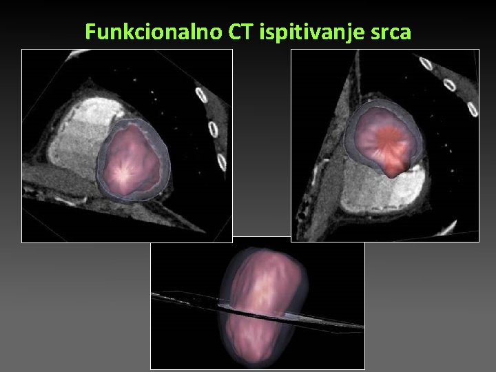Funkcionalno CT ispitivanje srca Funkcionalno CT ispitivanje srca