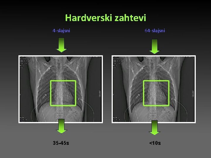 Hardverski zahtevi 4 -slajsni 64 -slajsni 35 -45 s <10 s Hardverski zahtevi 4 -slajsni 64 -slajsni 35 -45 s <10 s