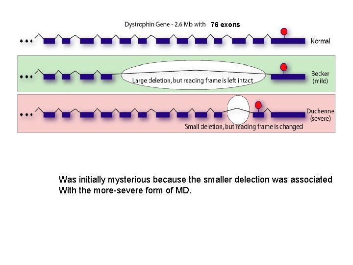 76 exons Was initially mysterious because the smaller delection was associated With the more-severe