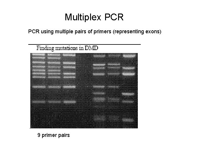 Multiplex PCR using multiple pairs of primers (representing exons) 9 primer pairs 