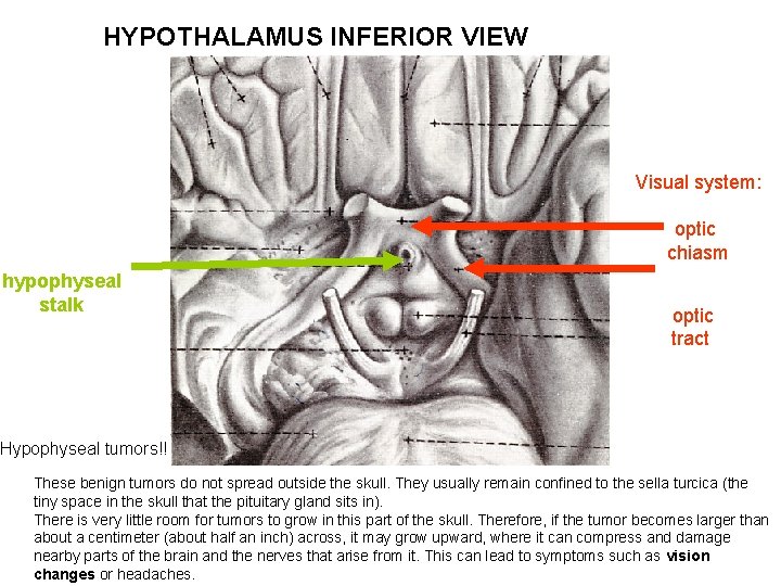 HYPOTHALAMUS INFERIOR VIEW Visual system: optic chiasm hypophyseal stalk optic tract Hypophyseal tumors!! These