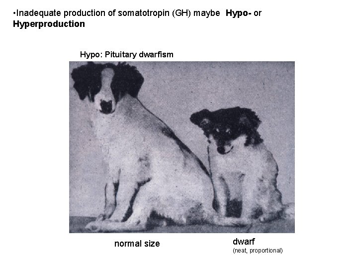  • Inadequate production of somatotropin (GH) maybe Hypo- or Hyperproduction Hypo: Pituitary dwarfism