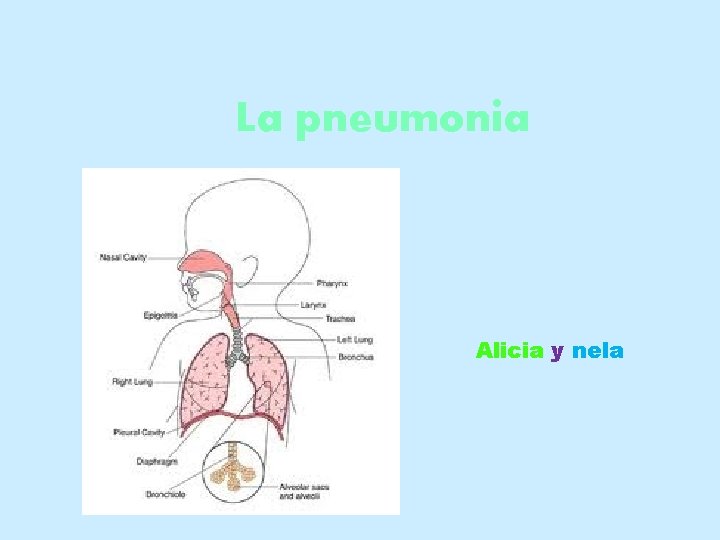 La pneumonia Alicia y nela 