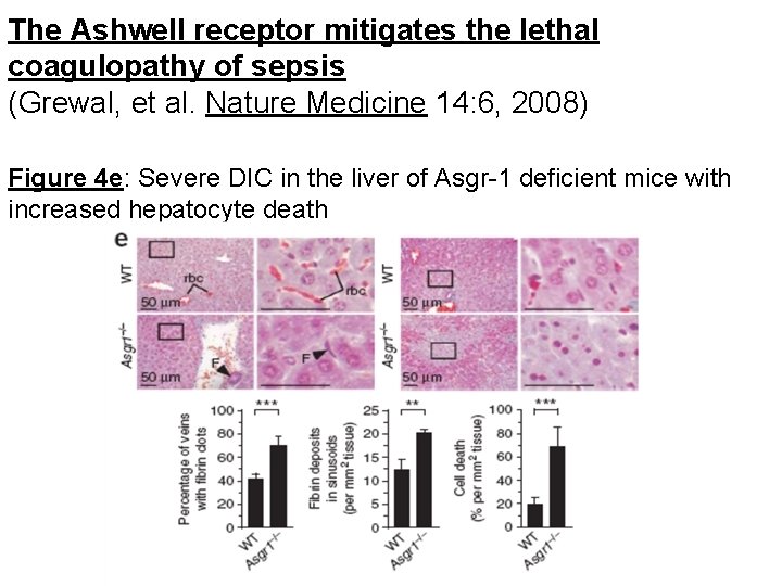 The Ashwell receptor mitigates the lethal coagulopathy of sepsis (Grewal, et al. Nature Medicine