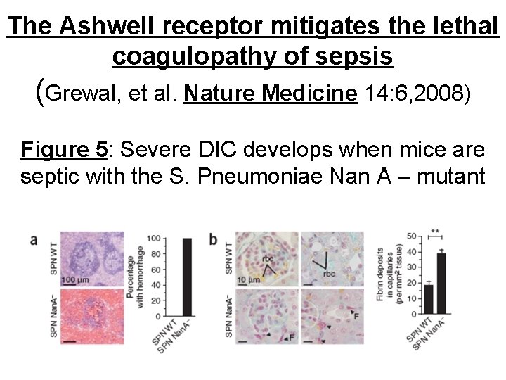 The Ashwell receptor mitigates the lethal coagulopathy of sepsis (Grewal, et al. Nature Medicine