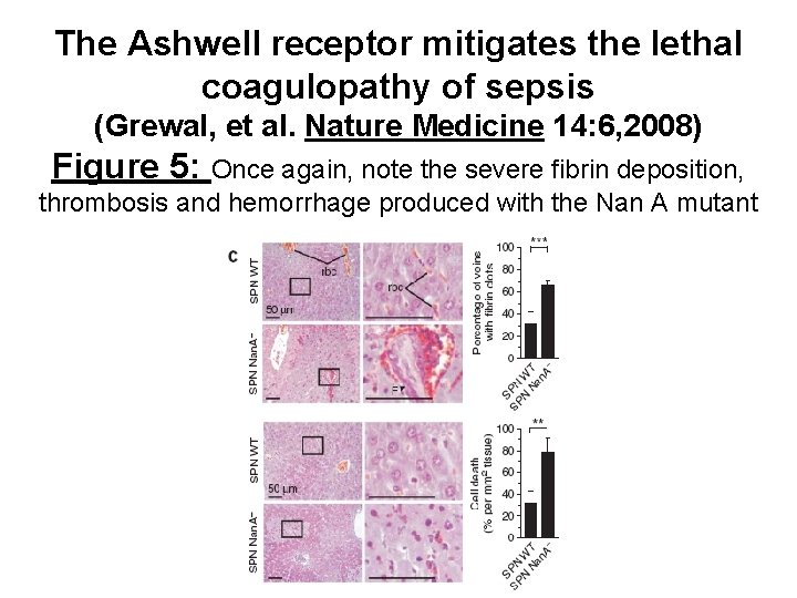 The Ashwell receptor mitigates the lethal coagulopathy of sepsis (Grewal, et al. Nature Medicine