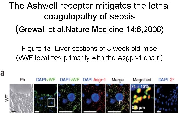 The Ashwell receptor mitigates the lethal coagulopathy of sepsis (Grewal, et al. Nature Medicine