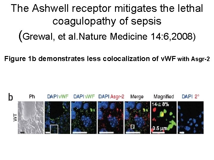 The Ashwell receptor mitigates the lethal coagulopathy of sepsis (Grewal, et al. Nature Medicine