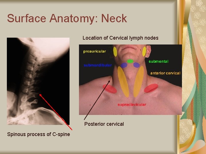 Surface Anatomy: Neck Location of Cervical lymph nodes Posterior cervical Spinous process of C-spine