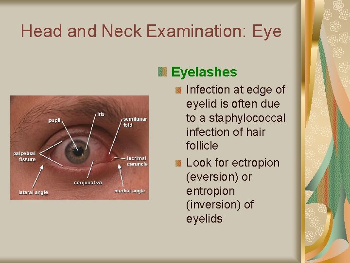 Head and Neck Examination: Eyelashes Infection at edge of eyelid is often due to