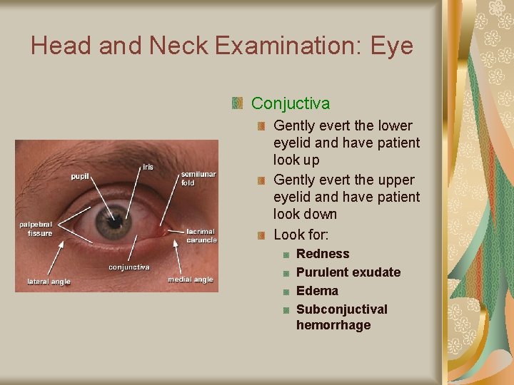 Head and Neck Examination: Eye Conjuctiva Gently evert the lower eyelid and have patient