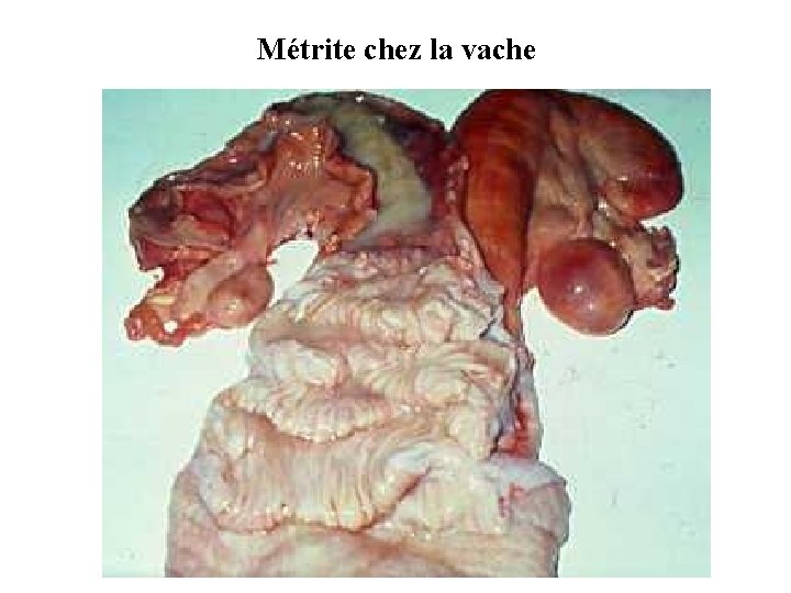 Métrite chez la vache 