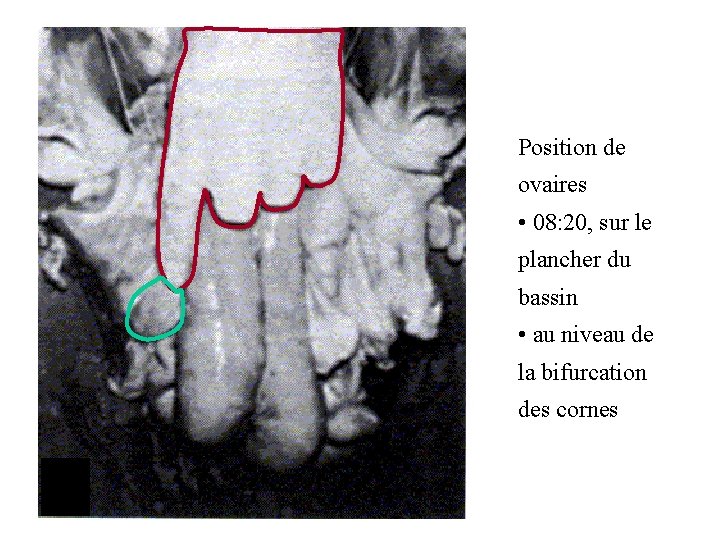 Position de ovaires • 08: 20, sur le plancher du bassin • au niveau