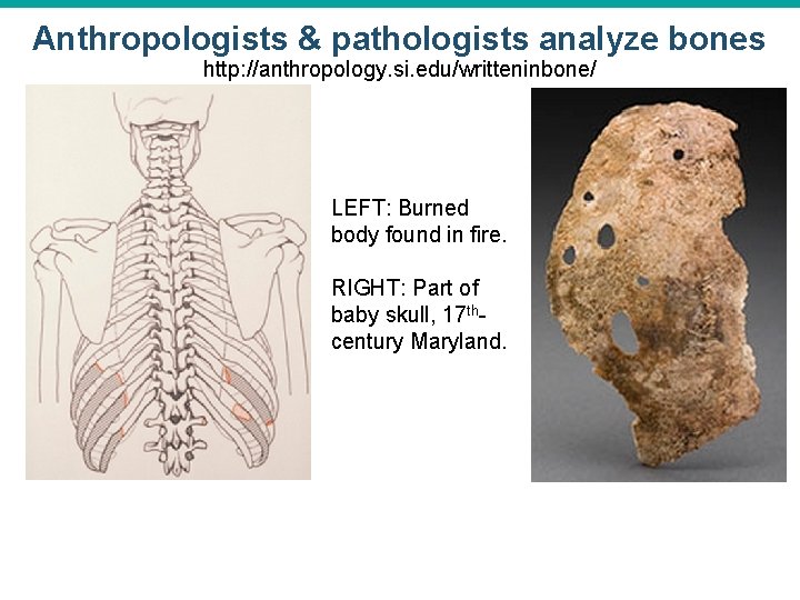 Anthropologists & pathologists analyze bones http: //anthropology. si. edu/writteninbone/ LEFT: Burned body found in