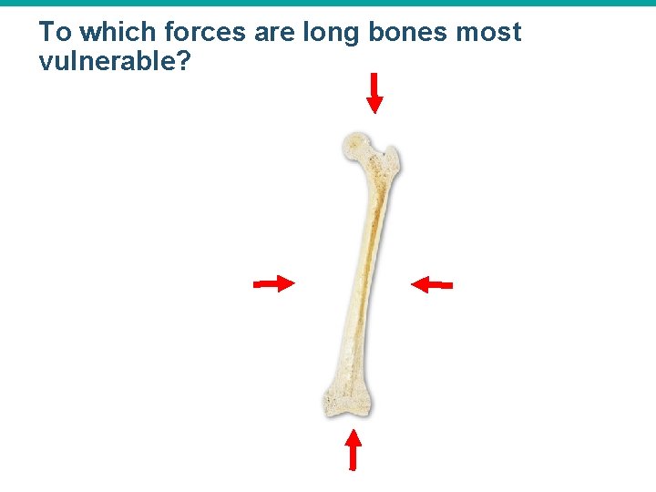 To which forces are long bones most vulnerable? 