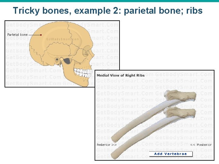 Tricky bones, example 2: parietal bone; ribs 