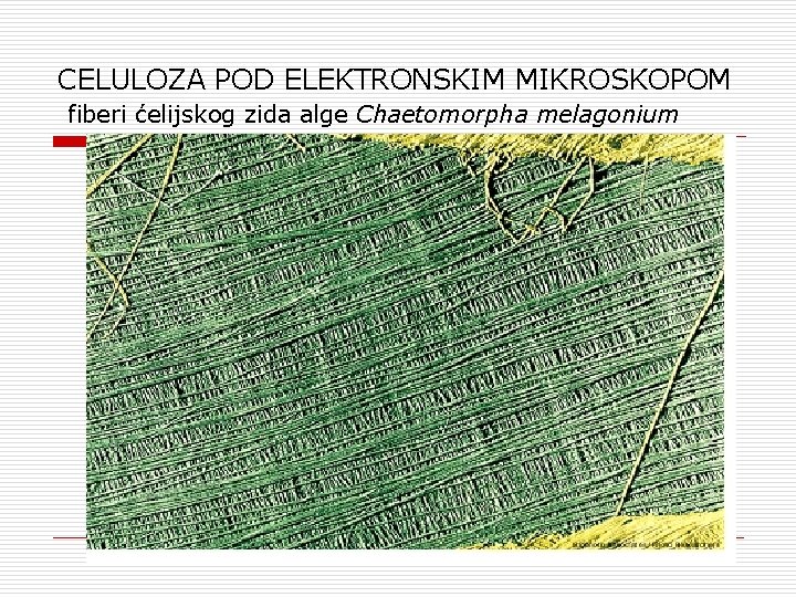CELULOZA POD ELEKTRONSKIM MIKROSKOPOM fiberi ćelijskog zida alge Chaetomorpha melagonium 