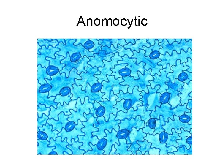 Anomocytic 