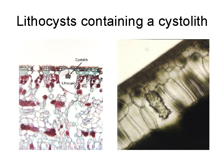 Lithocysts containing a cystolith 