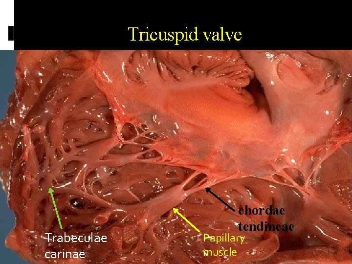 Tricuspid valve Trabeculae carinae chordae tendineae Papillary muscle 