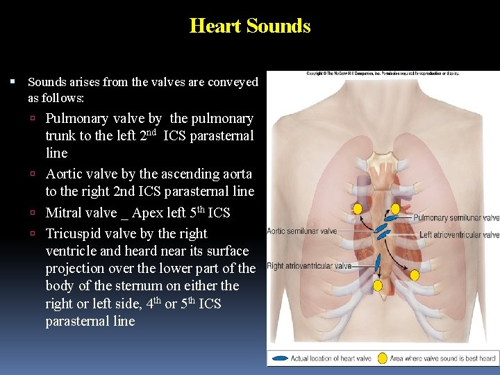 Heart Sounds arises from the valves are conveyed as follows: Pulmonary valve by the