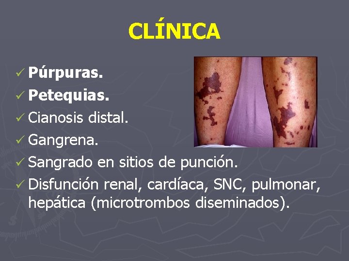 CLÍNICA ü Púrpuras. ü Petequias. ü Cianosis distal. ü Gangrena. ü Sangrado en sitios