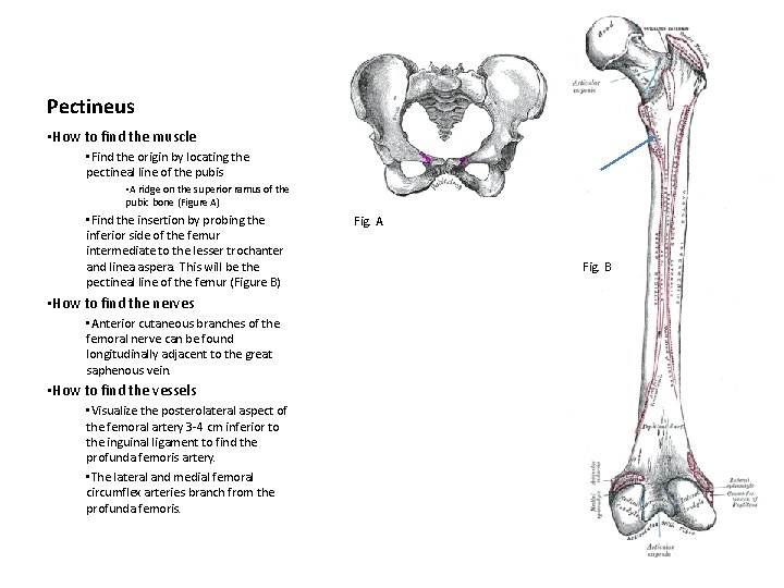 Pectineus • How to find the muscle • Find the origin by locating the