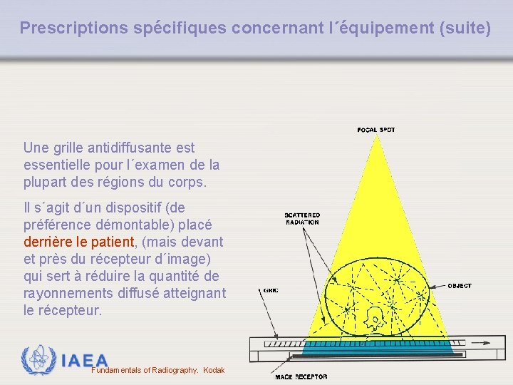 Prescriptions spécifiques concernant l´équipement (suite) Une grille antidiffusante est essentielle pour l´examen de la Prescriptions spécifiques concernant l´équipement (suite) Une grille antidiffusante est essentielle pour l´examen de la