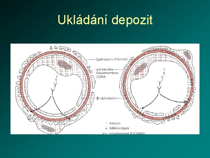 Ukládání depozit 