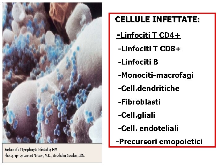 CELLULE INFETTATE: -Linfociti T CD 4+ -Linfociti T CD 8+ -Linfociti B -Monociti-macrofagi -Cell.