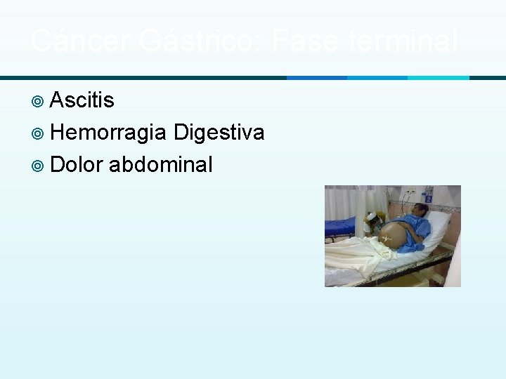 Cáncer Gástrico: Fase terminal ¥ Ascitis ¥ Hemorragia Digestiva ¥ Dolor abdominal 