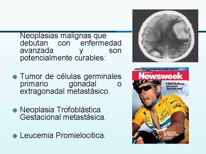 Neoplasias malignas que debutan con enfermedad avanzada y son potencialmente curables: ¥ Tumor de