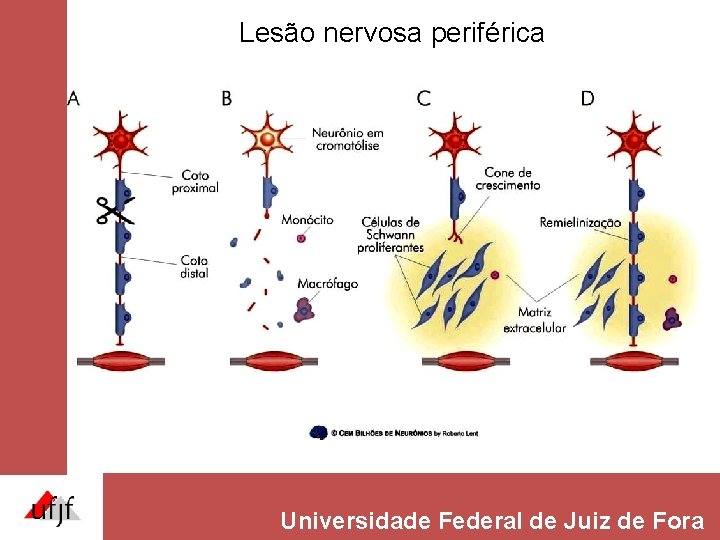 Lesão nervosa periférica Universidade Federal de Juiz de Fora Lesão nervosa periférica Universidade Federal de Juiz de Fora