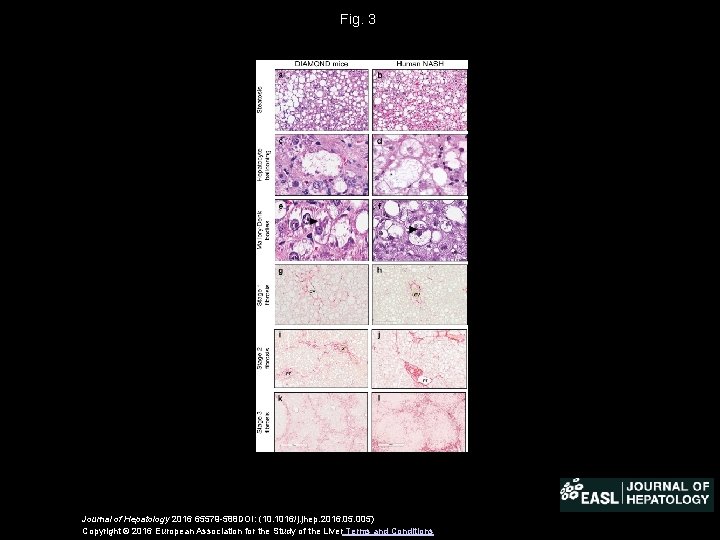 Fig. 3 Journal of Hepatology 2016 65579 -588 DOI: (10. 1016/j. jhep. 2016. 05.