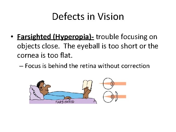 Defects in Vision • Farsighted (Hyperopia)- trouble focusing on objects close. The eyeball is Defects in Vision • Farsighted (Hyperopia)- trouble focusing on objects close. The eyeball is