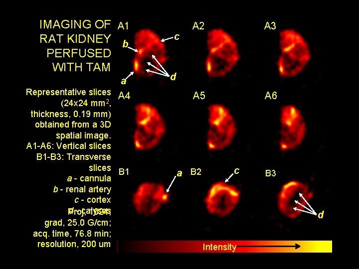 IMAGING OF A 1 RAT KIDNEY b PERFUSED WITH TAM a Representative slices A