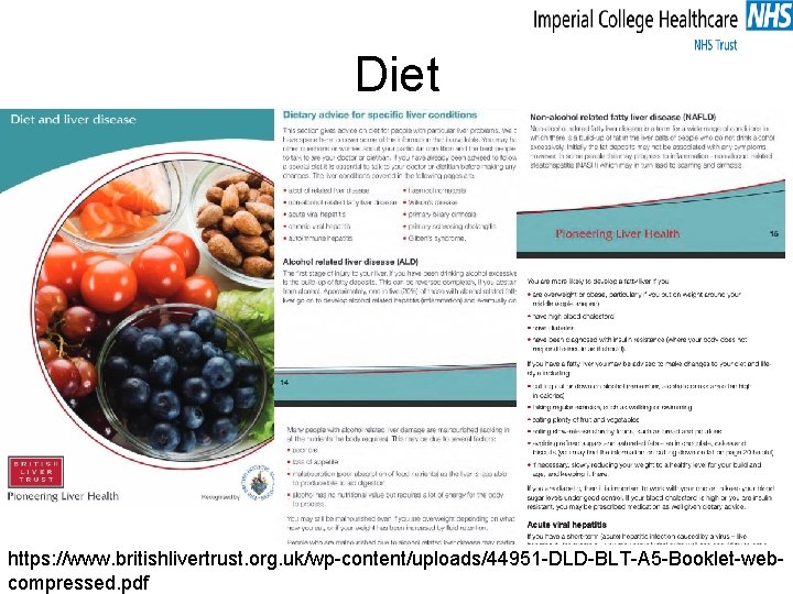 Diet https: //www. britishlivertrust. org. uk/wp-content/uploads/44951 -DLD-BLT-A 5 -Booklet-webcompressed. pdf 