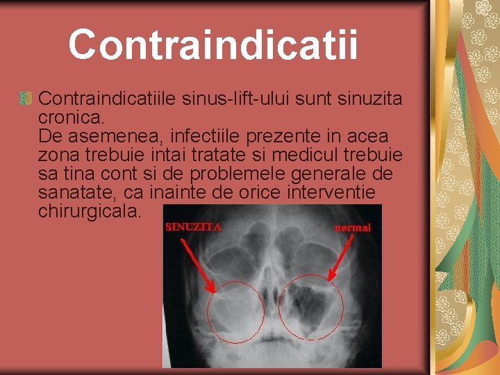 Contraindicatiile sinus-lift-ului sunt sinuzita cronica. De asemenea, infectiile prezente in acea zona trebuie intai