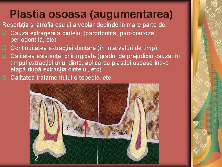 Plastia osoasa (augumentarea) Resorbţia şi atrofia osului alveolar depinde în mare parte de: Cauza