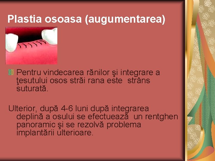 Plastia osoasa (augumentarea) Pentru vindecarea rănilor şi integrare a ţesutului osos străi rana este