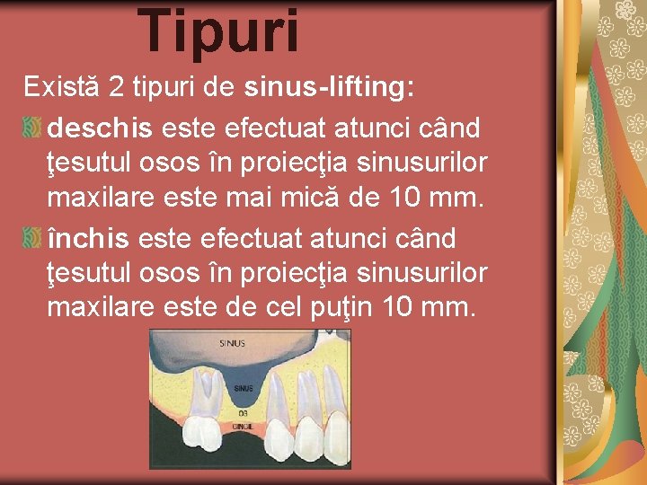 Tipuri Există 2 tipuri de sinus-lifting: deschis este efectuat atunci când ţesutul osos în