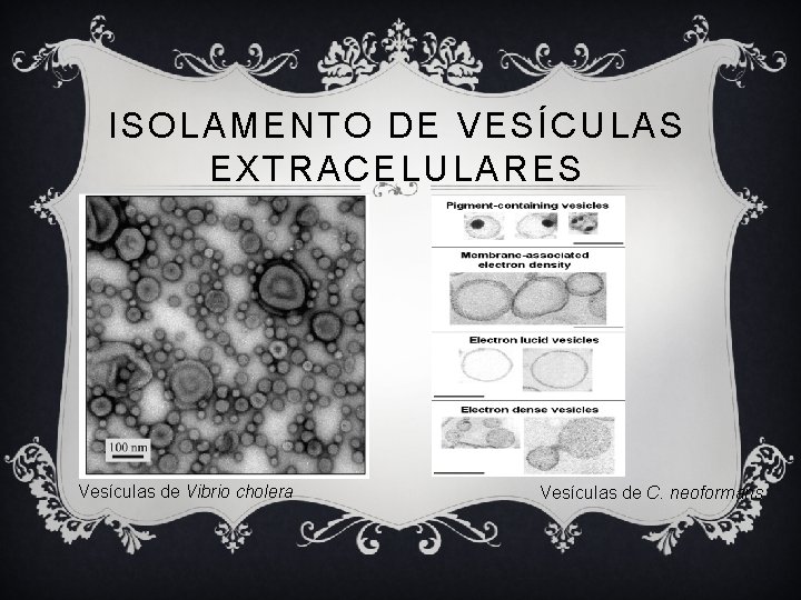 ISOLAMENTO DE VESÍCULAS EXTRACELULARES Vesículas de Vibrio cholera Vesículas de C. neoformans 